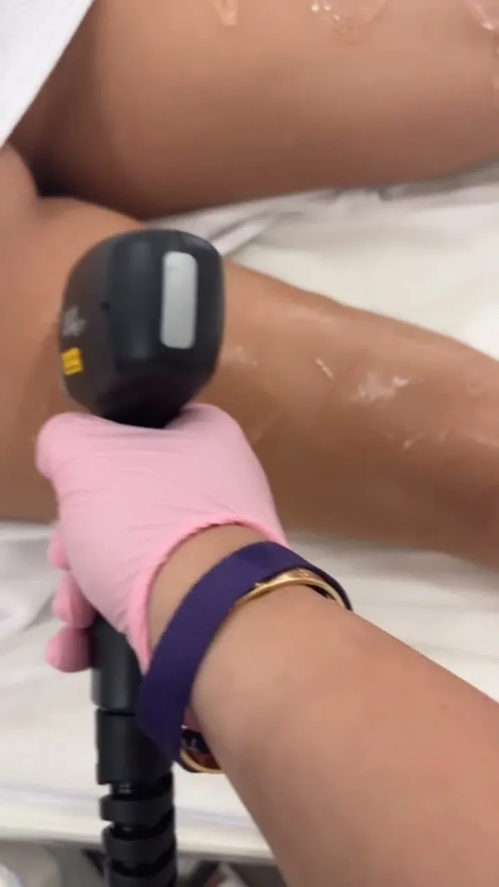 A gloved laser specialist treating a client’s lower leg